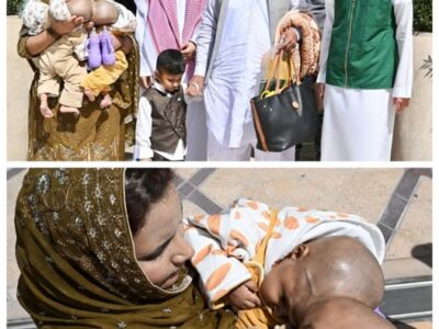 Saudi Arabia’s Global Leadership in Conjoined Twin Surgeries